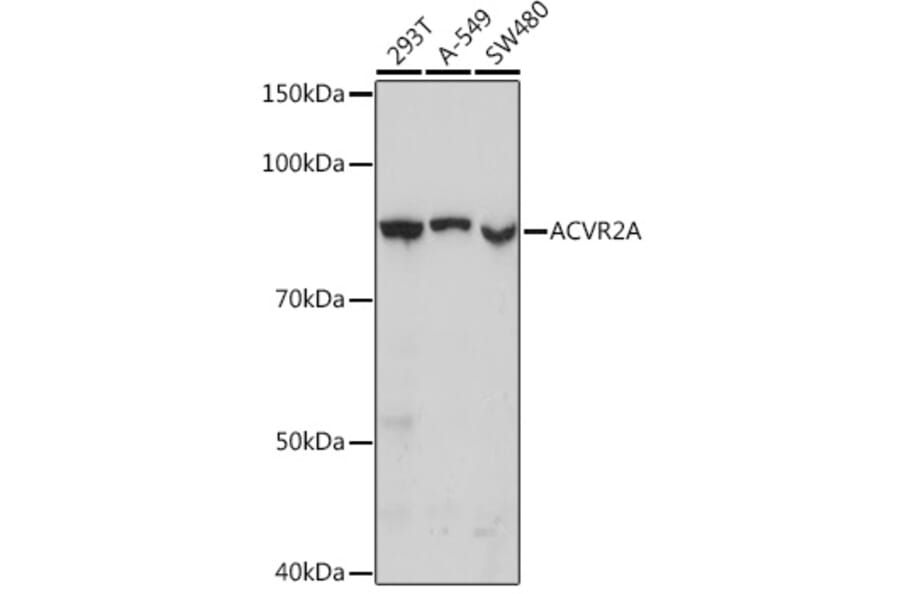 Western Blot - Anti-ACVR2A Antibody [ARC1220] (A329094) - Antibodies.com