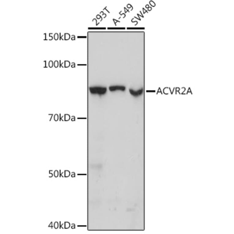 Western Blot - Anti-ACVR2A Antibody [ARC1220] (A329094) - Antibodies.com