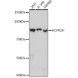 Western Blot - Anti-ACVR2A Antibody [ARC1220] (A329094) - Antibodies.com