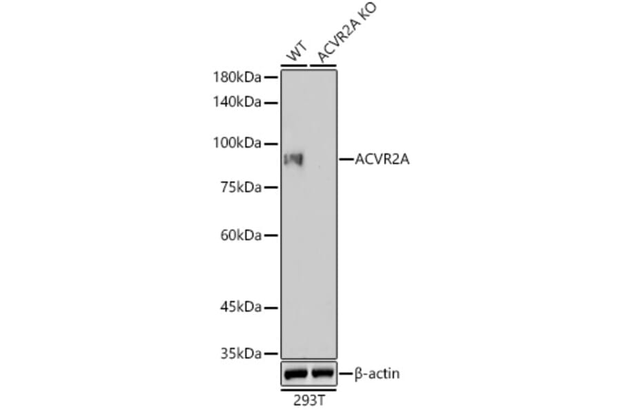 Western Blot - Anti-ACVR2A Antibody [ARC1220] (A329094) - Antibodies.com