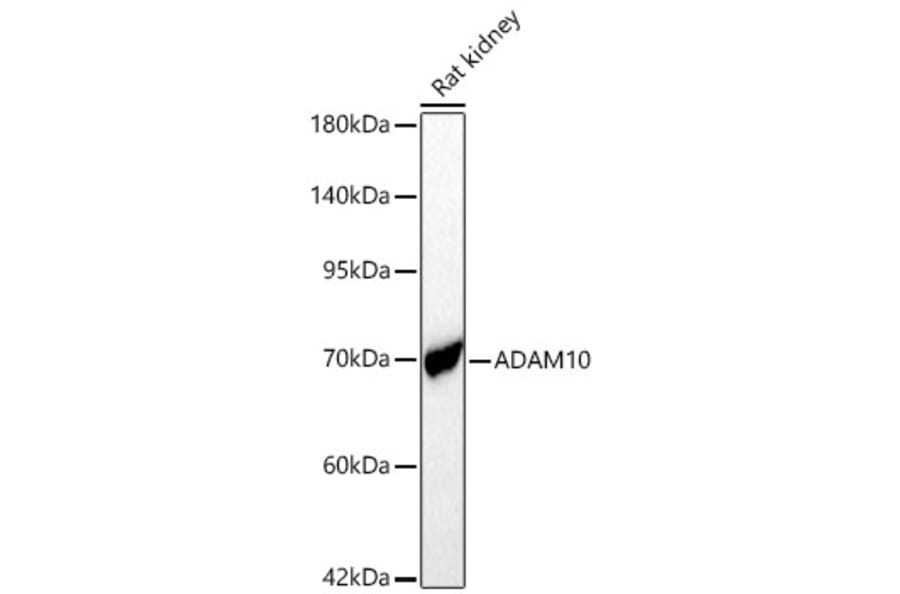 Western Blot - Anti-ADAM10 Antibody (A329095) - Antibodies.com