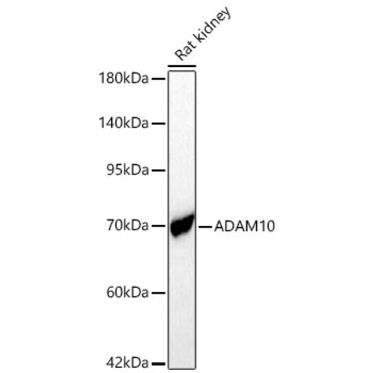 Western Blot - Anti-ADAM10 Antibody (A329095) - Antibodies.com