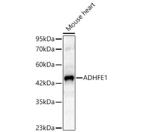 Western Blot - Anti-ADHFE1 Antibody (A329097) - Antibodies.com