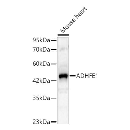 Western Blot - Anti-ADHFE1 Antibody (A329097) - Antibodies.com