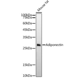 Western Blot - Anti-Adiponectin Antibody [ARC54368] (A329098) - Antibodies.com