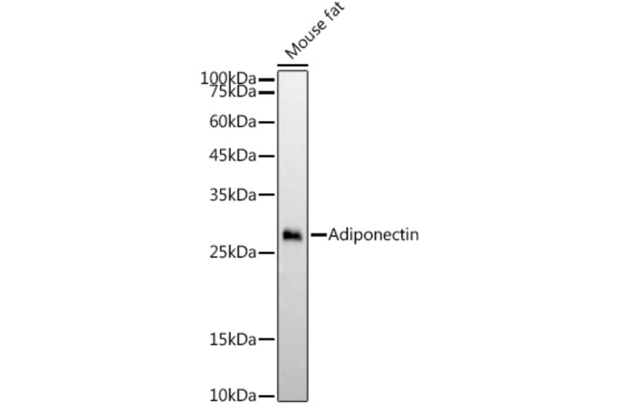 Western Blot - Anti-Adiponectin Antibody [ARC54368] (A329098) - Antibodies.com