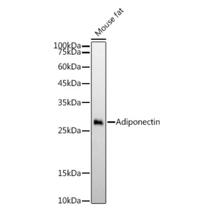 Western Blot - Anti-Adiponectin Antibody [ARC54368] (A329098) - Antibodies.com
