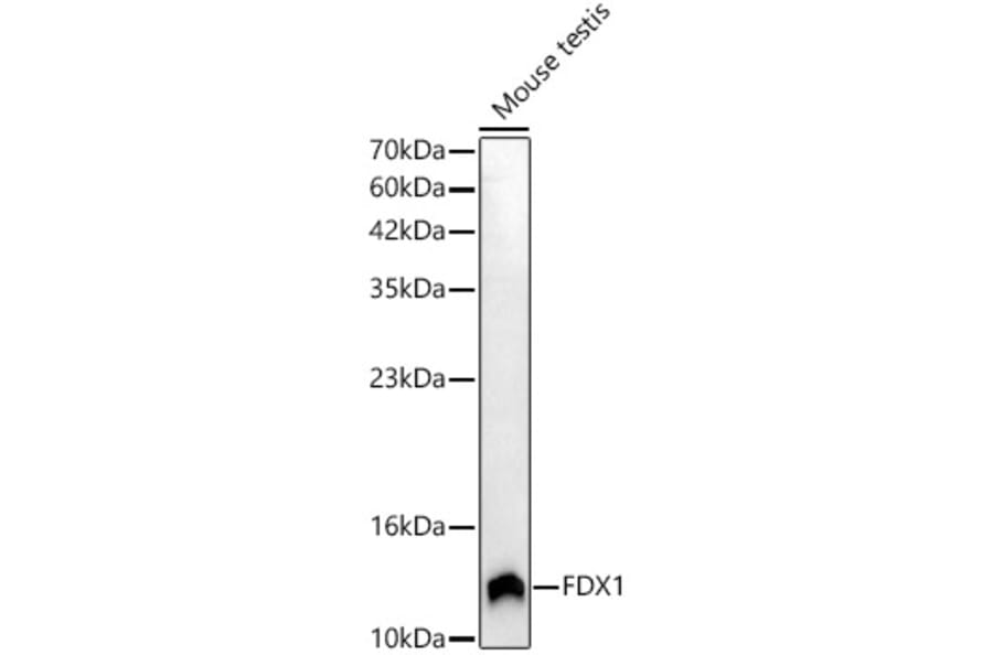 Western Blot - Anti-ADX Antibody (A329101) - Antibodies.com