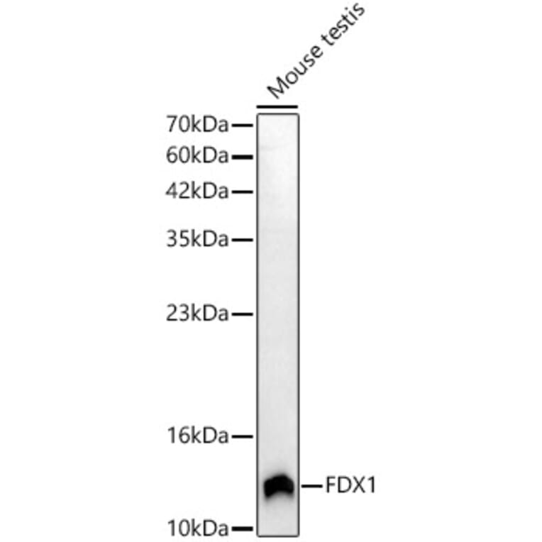 Western Blot - Anti-ADX Antibody (A329101) - Antibodies.com