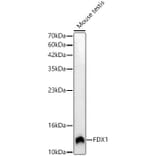 Western Blot - Anti-ADX Antibody (A329101) - Antibodies.com