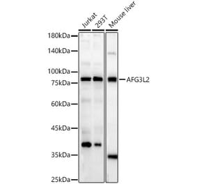 Western Blot - Anti-AFG3L2 Antibody (A329102) - Antibodies.com