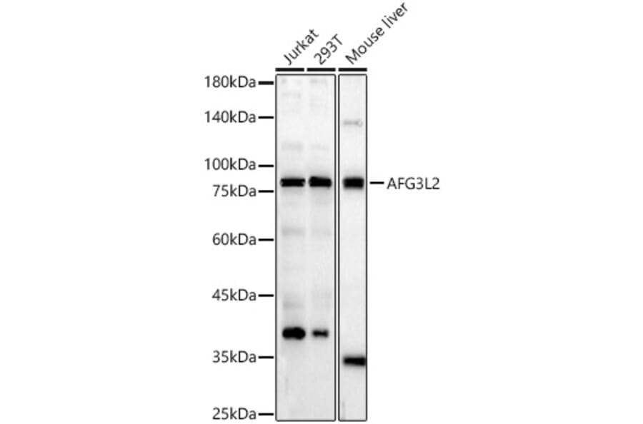 Western Blot - Anti-AFG3L2 Antibody (A329102) - Antibodies.com