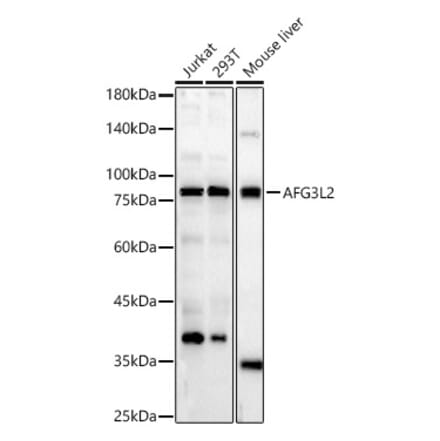 Western Blot - Anti-AFG3L2 Antibody (A329102) - Antibodies.com