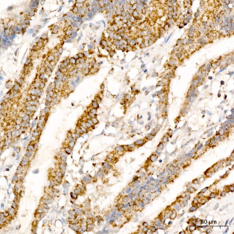 Immunohistochemistry - Anti-AFG3L2 Antibody (A329102) - Antibodies.com