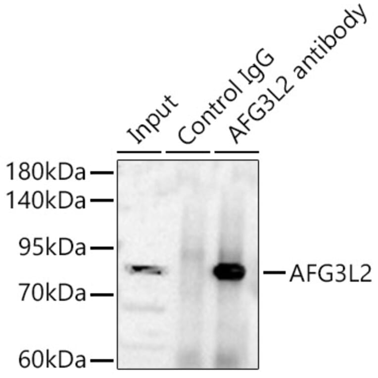Immunoprecipitation - Anti-AFG3L2 Antibody (A329102) - Antibodies.com