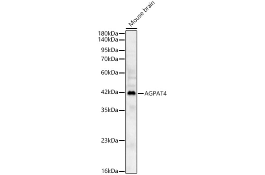 Western Blot - Anti-AGPAT4 Antibody (A329105) - Antibodies.com