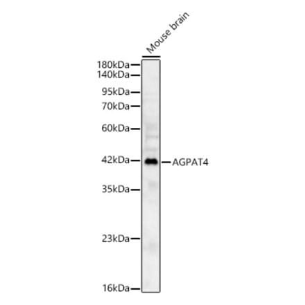 Western Blot - Anti-AGPAT4 Antibody (A329105) - Antibodies.com
