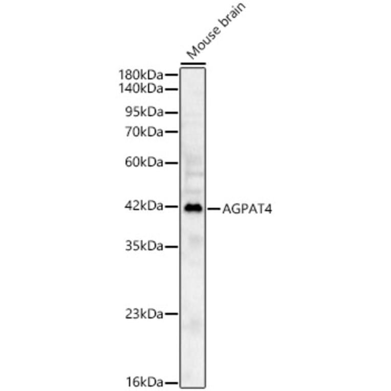 Western Blot - Anti-AGPAT4 Antibody (A329105) - Antibodies.com