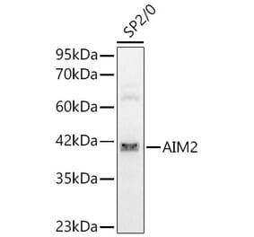 Western Blot - Anti-AIM2 Antibody (A329106) - Antibodies.com