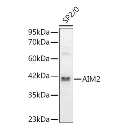 Western Blot - Anti-AIM2 Antibody (A329106) - Antibodies.com