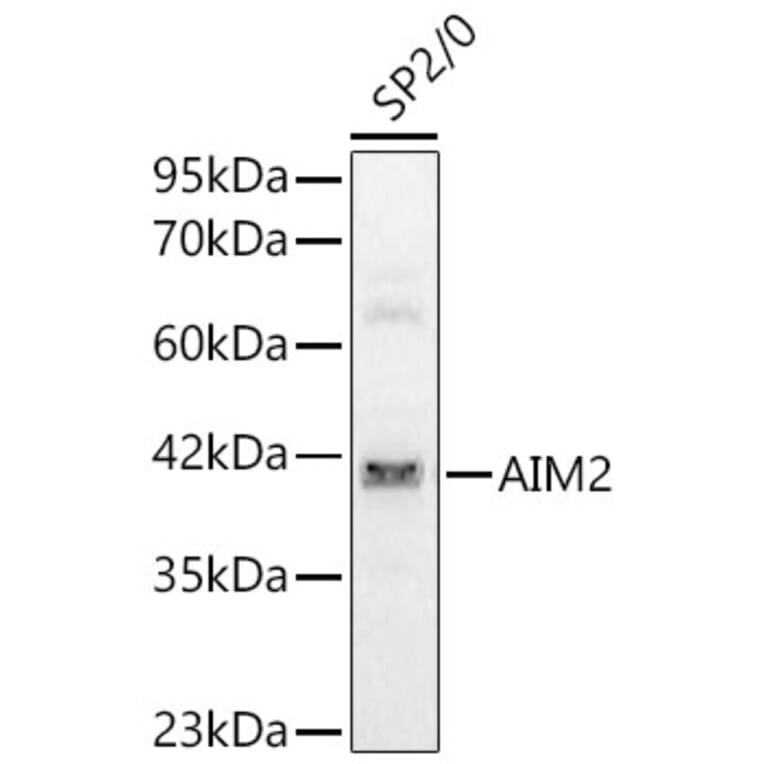 Western Blot - Anti-AIM2 Antibody (A329106) - Antibodies.com