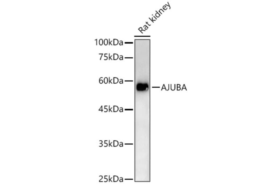 Western Blot - Anti-Ajuba Antibody (A329107) - Antibodies.com