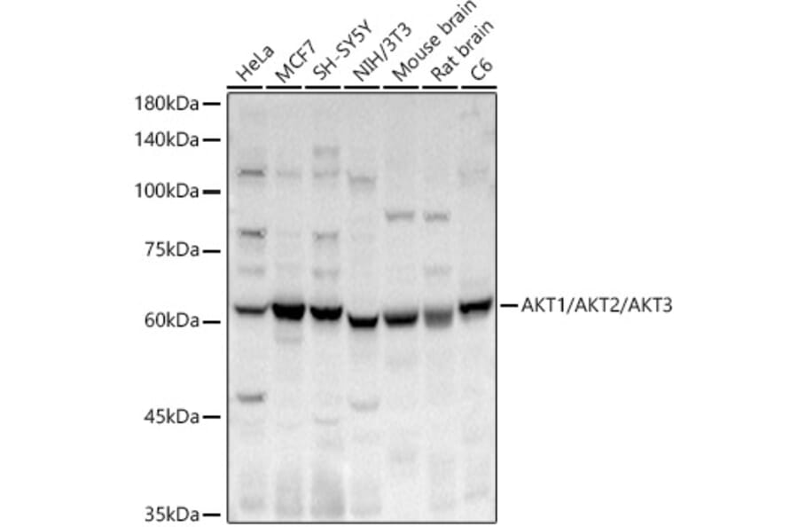 Western Blot - Anti-AKT1+AKT2+AKT3 Antibody (A329108) - Antibodies.com