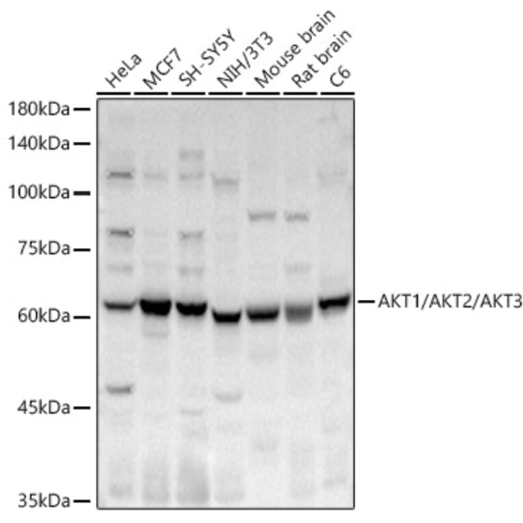 Western Blot - Anti-AKT1+AKT2+AKT3 Antibody (A329108) - Antibodies.com