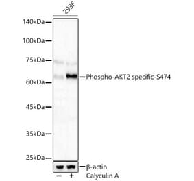 Western Blot - Anti-AKT2 (Phospho S474) Antibody (A329109) - Antibodies.com