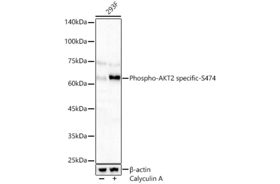 Western Blot - Anti-AKT2 (Phospho S474) Antibody (A329109) - Antibodies.com