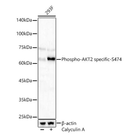 Western Blot - Anti-AKT2 (Phospho S474) Antibody (A329109) - Antibodies.com