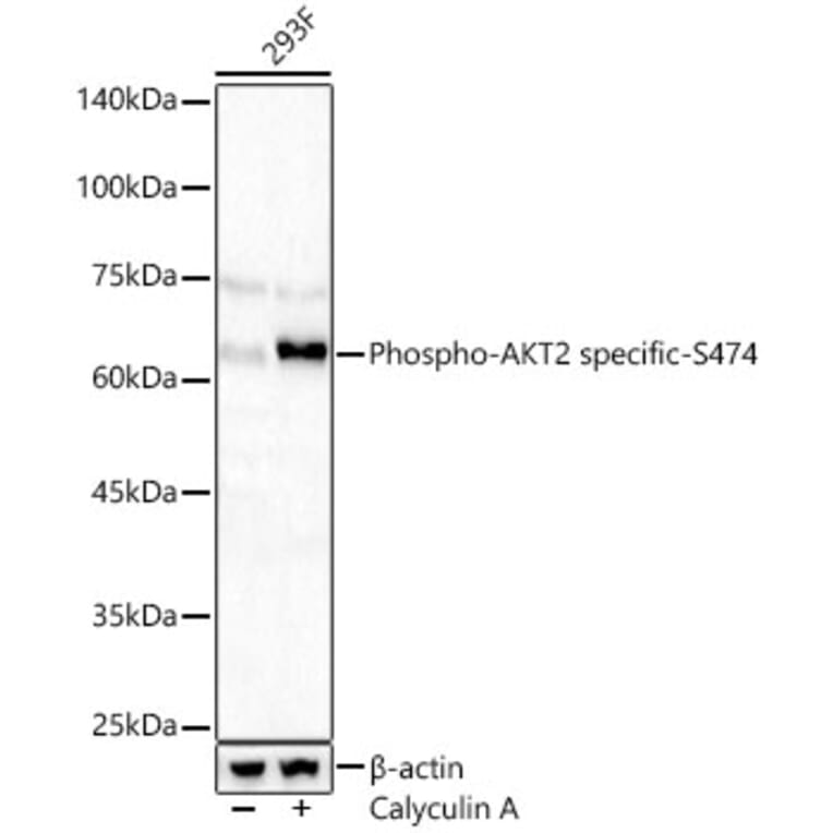 Western Blot - Anti-AKT2 (Phospho S474) Antibody (A329109) - Antibodies.com