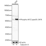 Western Blot - Anti-AKT2 (Phospho S474) Antibody (A329109) - Antibodies.com