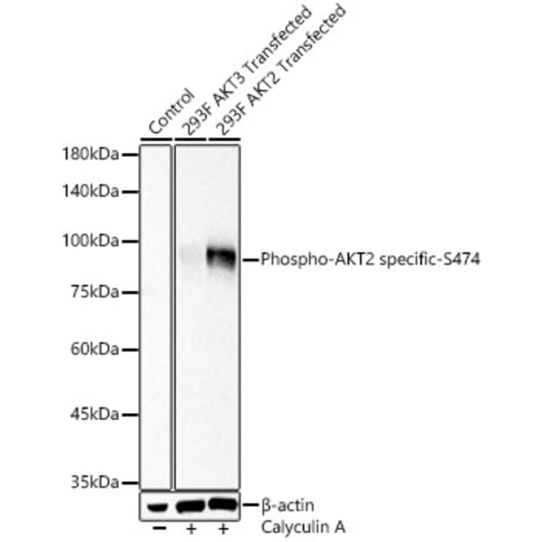 Western Blot - Anti-AKT2 (Phospho S474) Antibody (A329109) - Antibodies.com