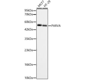 Western Blot - Anti-alpha Parvin Antibody (A329112) - Antibodies.com