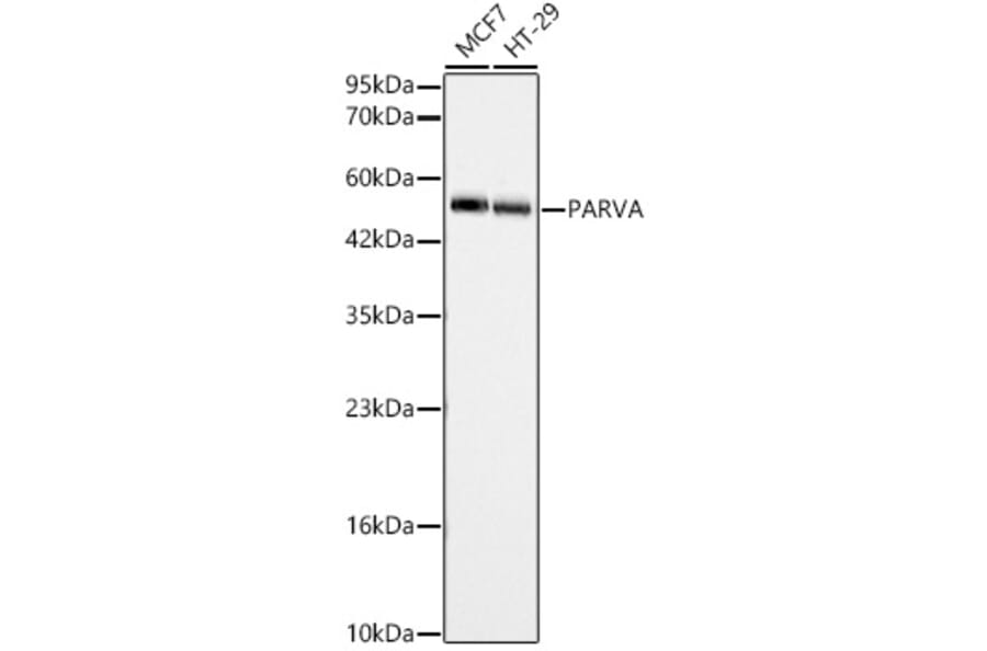 Western Blot - Anti-alpha Parvin Antibody (A329112) - Antibodies.com
