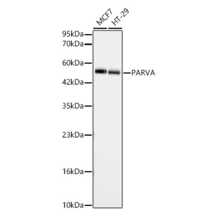 Western Blot - Anti-alpha Parvin Antibody (A329112) - Antibodies.com
