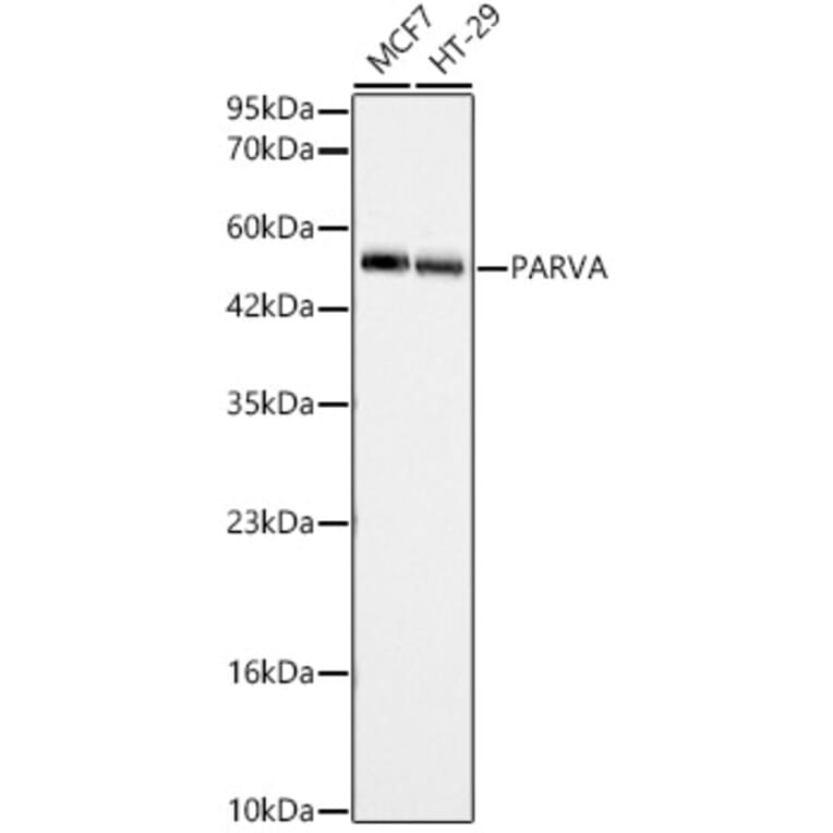 Western Blot - Anti-alpha Parvin Antibody (A329112) - Antibodies.com