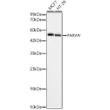 Western Blot - Anti-alpha Parvin Antibody (A329112) - Antibodies.com