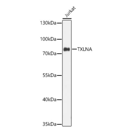 Western Blot - Anti-alpha Taxilin Antibody (A329113) - Antibodies.com