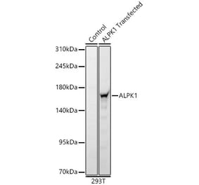 Western Blot - Anti-ALPK1 Antibody (A329114) - Antibodies.com