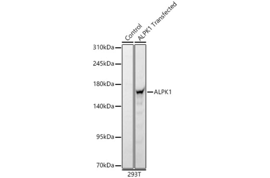 Western Blot - Anti-ALPK1 Antibody (A329114) - Antibodies.com