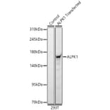 Western Blot - Anti-ALPK1 Antibody (A329114) - Antibodies.com