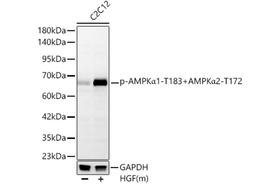 Western Blot - Anti-AMPK alpha 1 + AMPK alpha 2 (Phospho T183 & Phospho T172) Antibody [ARC62278] (A329115) - Antibodies.com