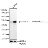 Western Blot - Anti-AMPK alpha 1 + AMPK alpha 2 (Phospho T183 & Phospho T172) Antibody [ARC62278] (A329115) - Antibodies.com