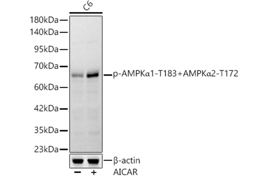 Western Blot - Anti-AMPK alpha 1 + AMPK alpha 2 (Phospho T183 & Phospho T172) Antibody [ARC62278] (A329115) - Antibodies.com