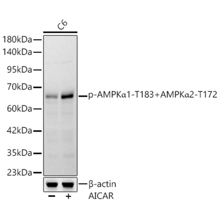 Western Blot - Anti-AMPK alpha 1 + AMPK alpha 2 (Phospho T183 & Phospho T172) Antibody [ARC62278] (A329115) - Antibodies.com