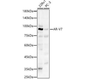 Western Blot - Anti-Androgen Receptor Antibody (A329116) - Antibodies.com