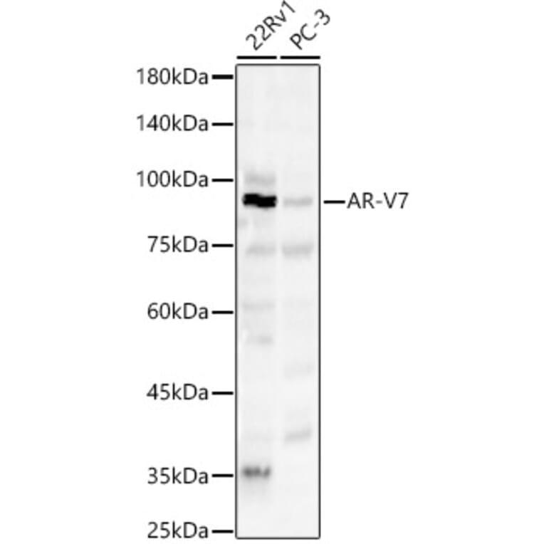 Western Blot - Anti-Androgen Receptor Antibody (A329116) - Antibodies.com