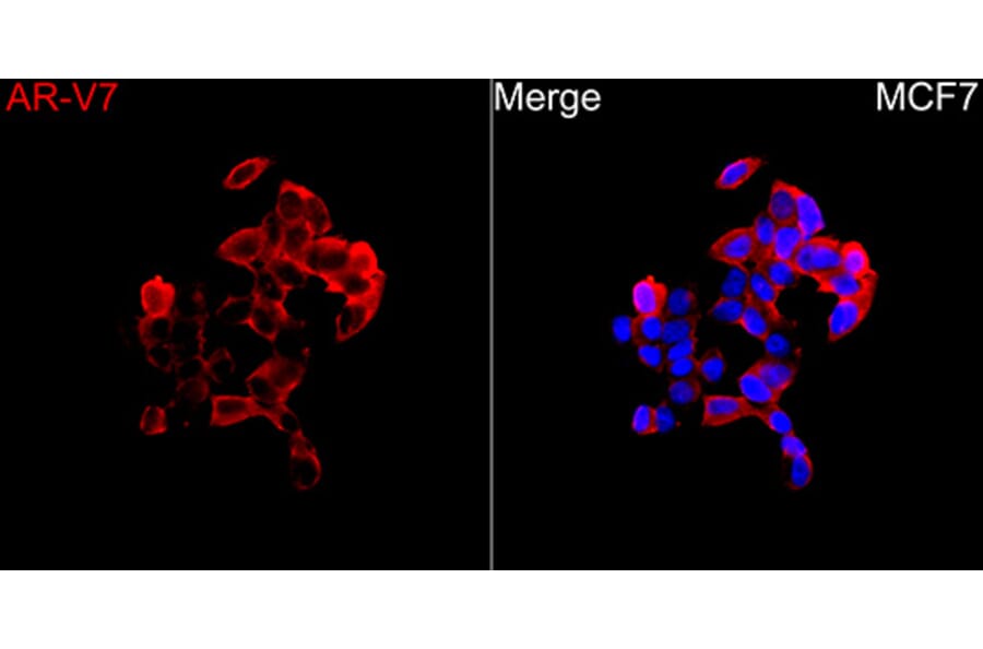 Immunofluorescence - Anti-Androgen Receptor Antibody (A329116) - Antibodies.com